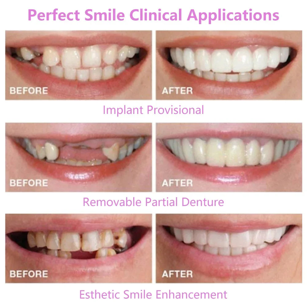 Upper & Lower Fake Teeth Covers – Comfortable Flexible Veneers for Whitening, Braces, and Fun Toy Use