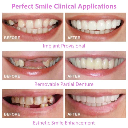 Upper & Lower Fake Teeth Covers – Comfortable Flexible Veneers for Whitening, Braces, and Fun Toy Use
