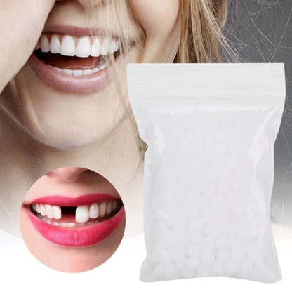 Temporary Tooth Repair Beads – Dental Filling Material for Broken or Missing Teeth