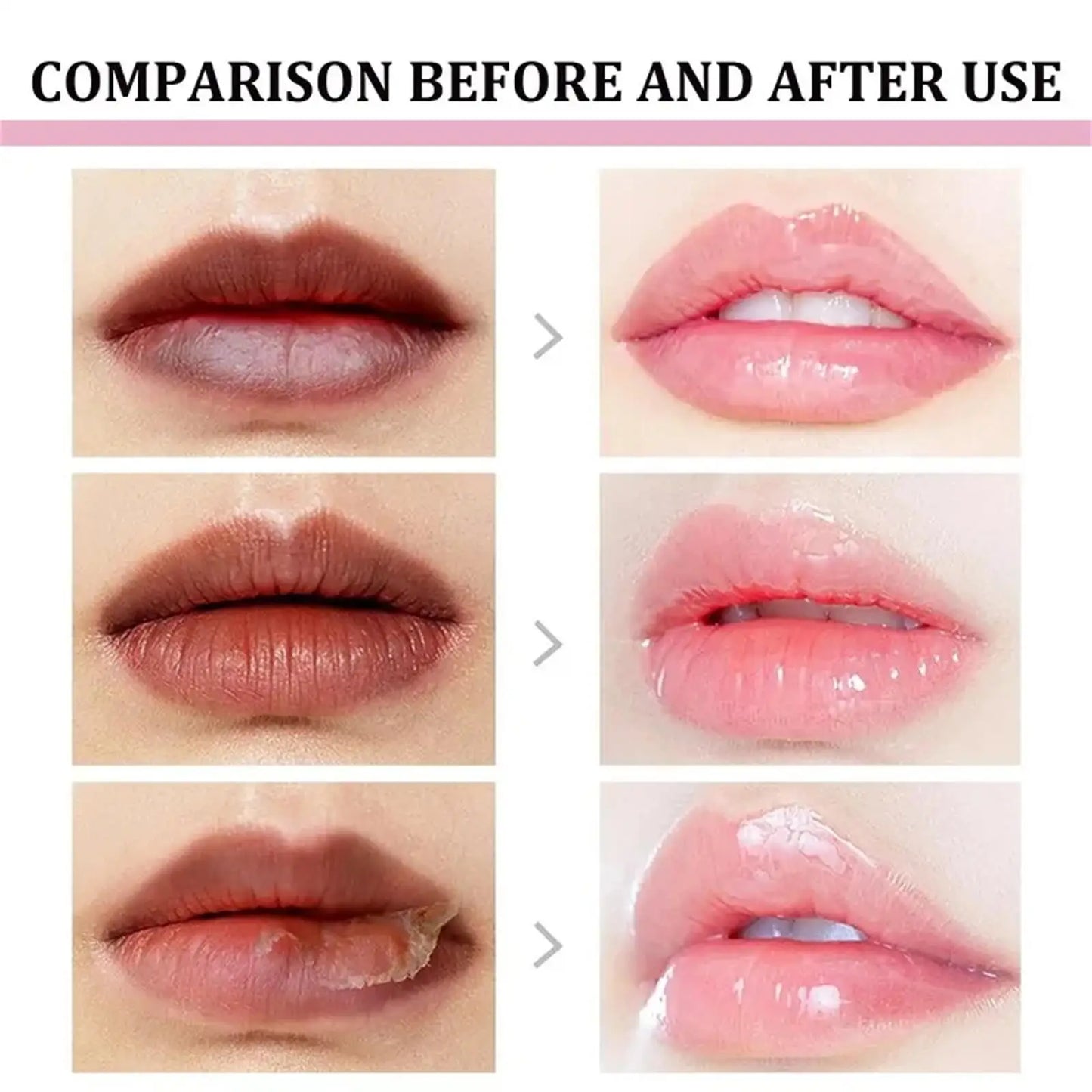 Lip Lightening Balm – Melanin Removing Gloss for Exfoliating and Moisturizing