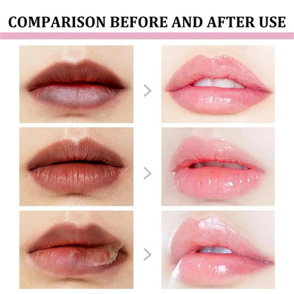 Lip Lightening Balm – Melanin Removing Gloss for Exfoliating and Moisturizing