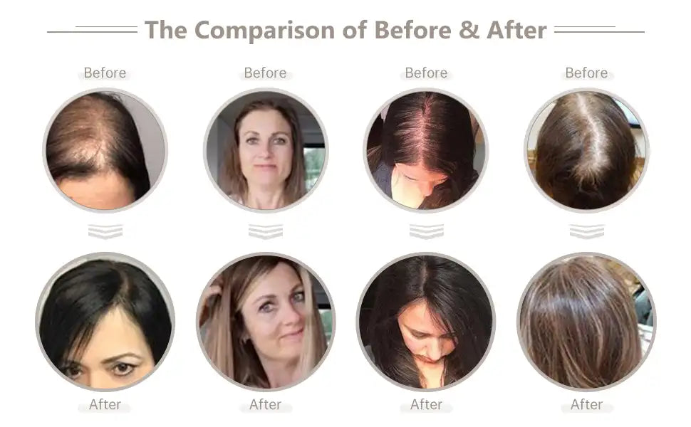 Silk Top Base Clip-In Hair Topper for Women – Real Human Hair Extension, Thin & Breathable Hairpiece