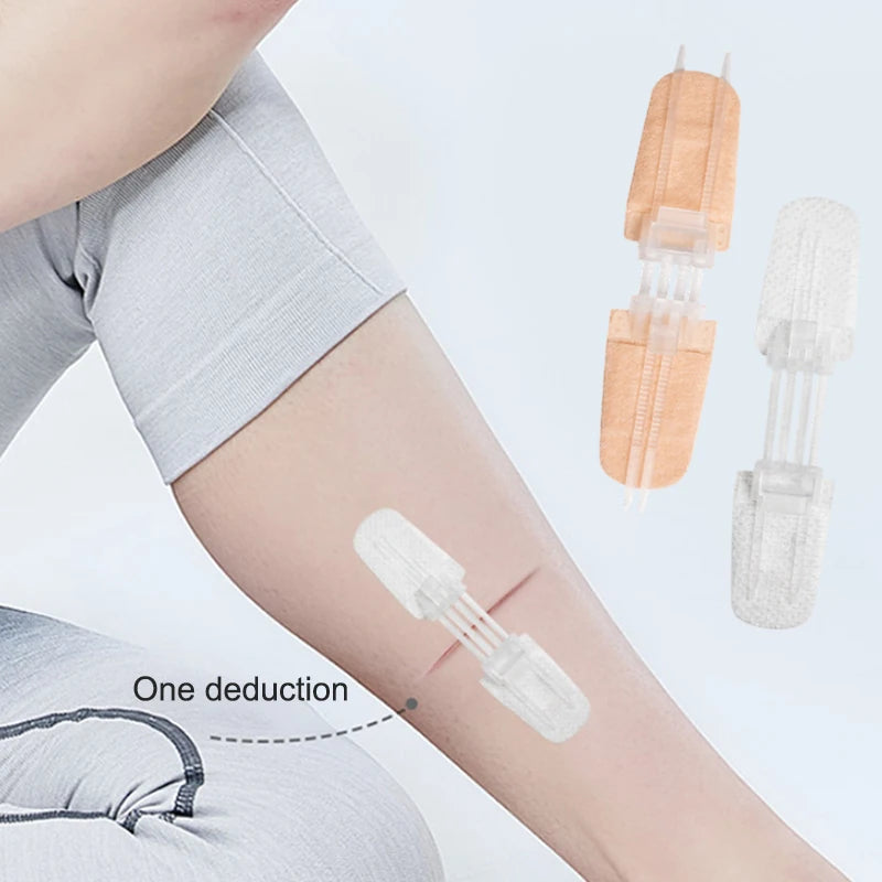 1–20-Piece Zipper Wound Closure Patch Set - Suture-Free Wound Dressing Strips for First Aid and Outdoor Care