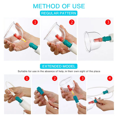 12/20/24 Cans Vacuum Acupuncture Cupping Set – Anti-Cellulite & Physiotherapy Suction Cup Massage Therapy