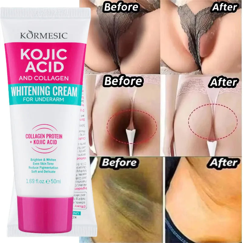Brightening Body Serum Cream – Underarm, Knee & Inner Thigh Skin Care Moisturizer for Even Tone, Dark Spot Care & Smooth Skin Appearance