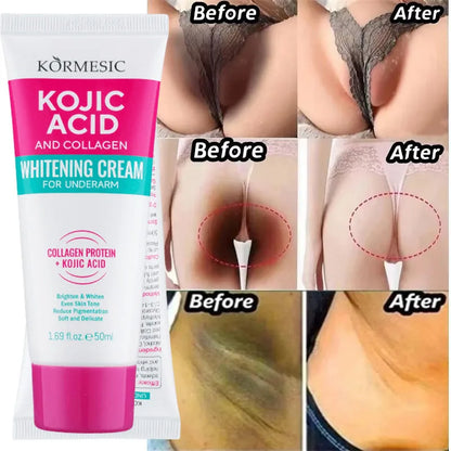 Brightening Body Serum Cream – Underarm, Knee & Inner Thigh Skin Care Moisturizer for Even Tone, Dark Spot Care & Smooth Skin Appearance