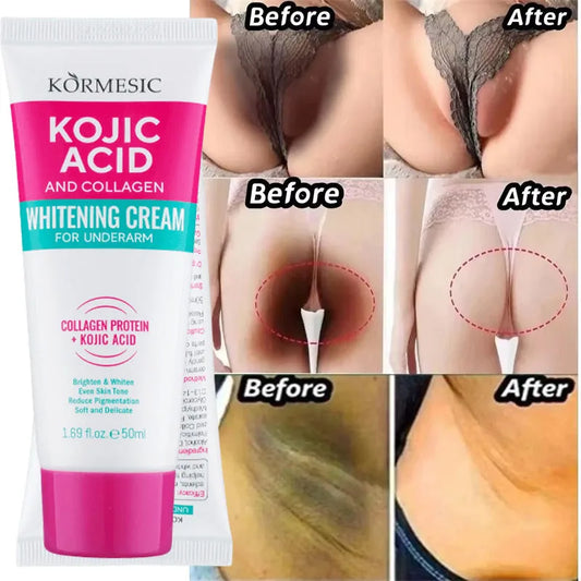 Whitening Cream for Underarms, Knees & Inner Thighs – Brightening Moisturizing Body Serum for Even Skin Tone Care