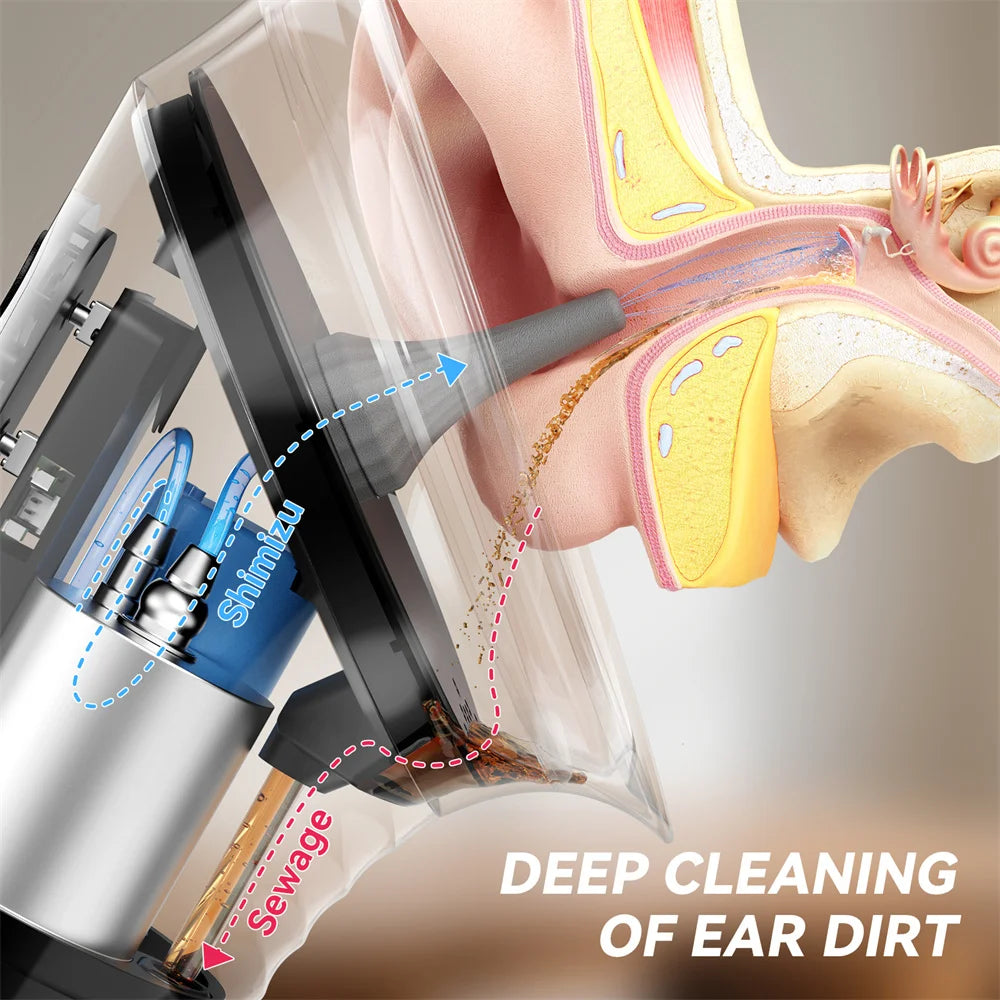 Upgraded Ear Wax Removal Kit – Intelligent Ear Cleaner with Waste Water Tank & Temperature Sensor, Safe Low-Pressure Ear Irrigation System for Effective Wax Cleaning