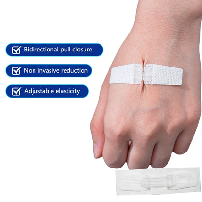 Zipper Wound Closure Patches - Painless Suture-Free Dressing for First Aid and Outdoor Use