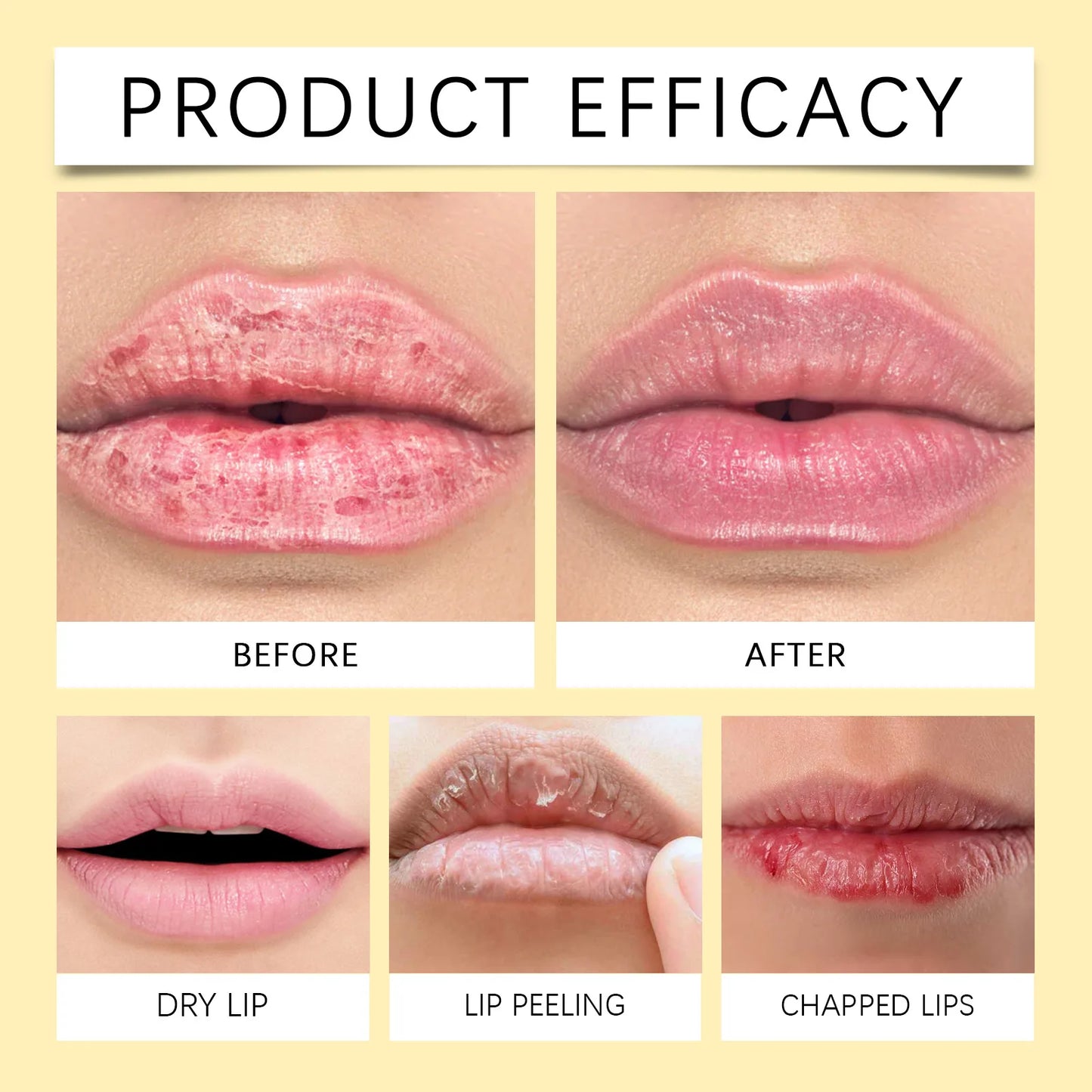Lip Lightening Balm – Melanin Removing Gloss for Exfoliating and Moisturizing