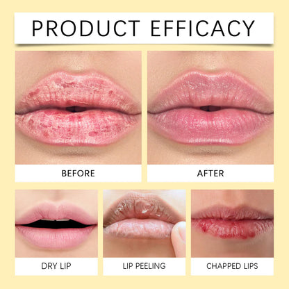 Lip Lightening Balm – Melanin Removing Gloss for Exfoliating and Moisturizing