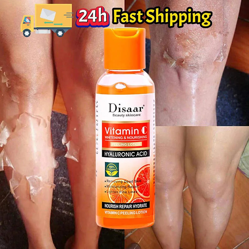 Yellow Peeling Lotion Oil – 100% Organic Exfoliating, Whitening & Nourishing Body Scrub with Hyaluronic Acid for Dark Skin
