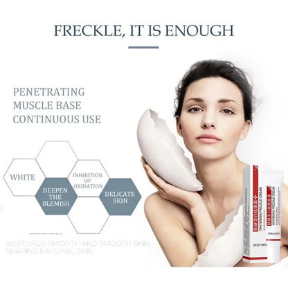 Whitening Freckle Cream - Niacinamide Dark Spot Remover Face Cream for Pigmentation, Melasma & Skin Brightening Care 20g