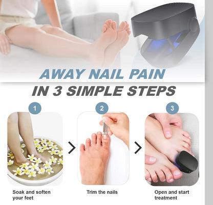 Nail Fungus Cleaning Light Device – USB Charge, 905nm Infrared & 470nm Blue Light for Onychomycosis Treatment