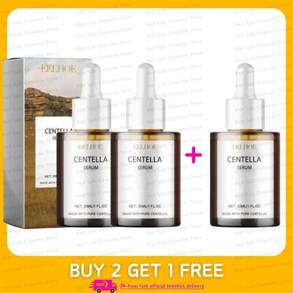 Centella Asiatica Face Serum – Nourishing, Brightening & Moisturizing Cream for Dry Skin Rejuvenation