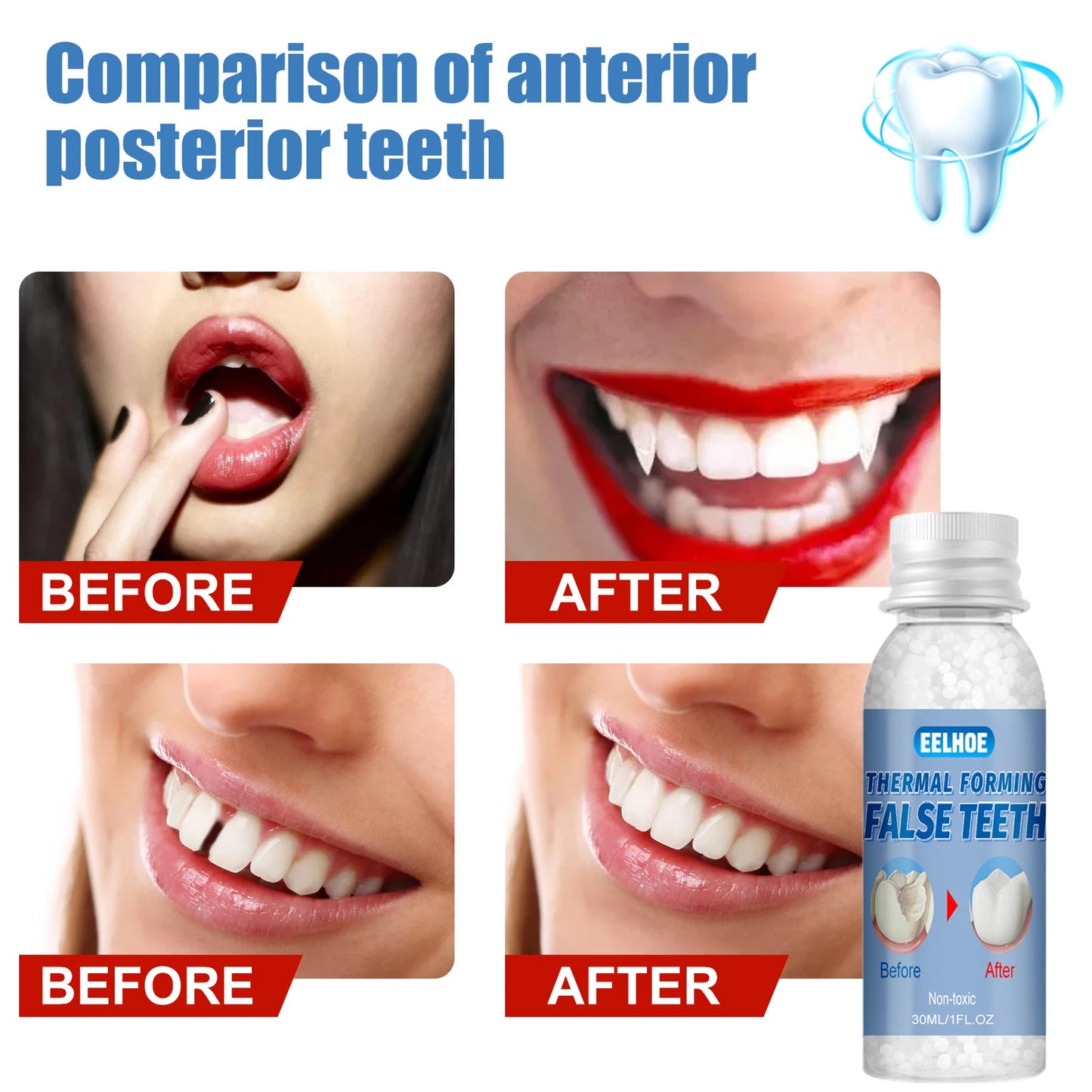 Resin False Teeth & Solid Gums — Temporary Filling Material for Dentistry, Oral Care, Denture Restoration 20/30ml