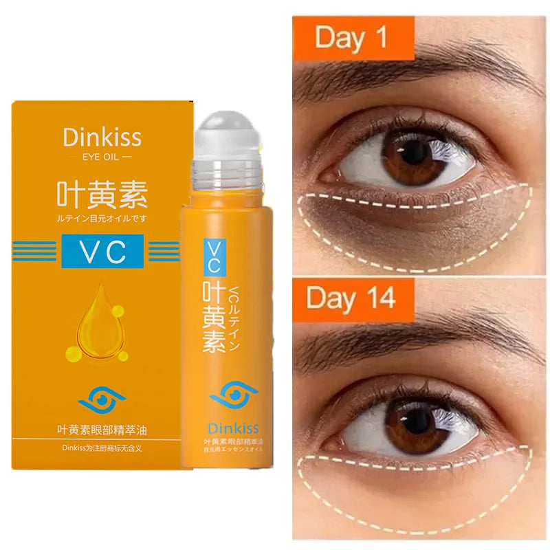 Anti-Dark Circle Eye Serum — Retinol Oil for Wrinkle Removal, Firming, Eye Bag Reduction, Fine Line Fading & Brightening Korean Eye Care