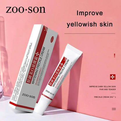 Whitening Freckle Cream - Niacinamide Dark Spot Remover Face Cream for Pigmentation, Melasma & Skin Brightening Care 20g