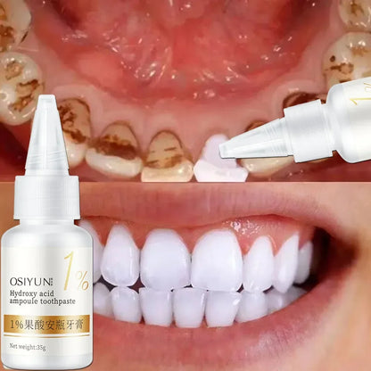 Teeth Whitening Toothpaste – Fruit Acid Formula for Plaque Removal, Stain & Calculus Cleanser, Fresh Breath & Oral Hygiene