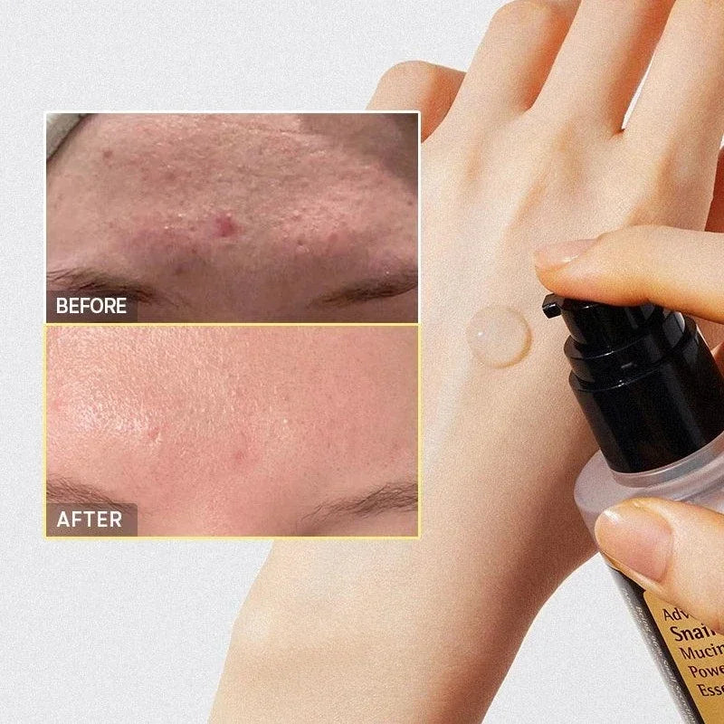 Korean Snail Collagen Face Cream – Moisturizing, Firming, Repairing Essence Skin Care