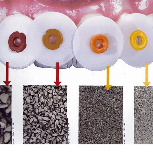 Dental Polishing Disc Kit - 40/50pcs Finishing & Refining Discs with Mandrel for Composite Restoration