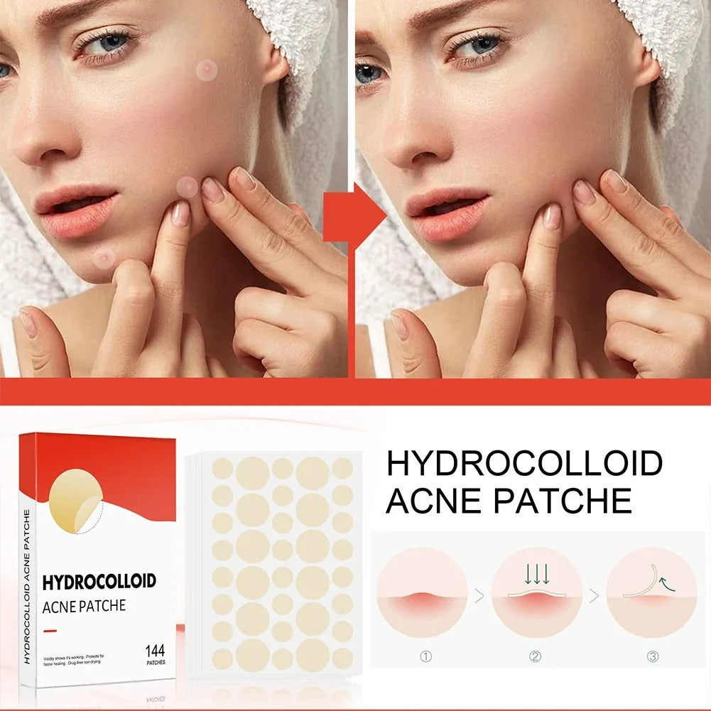 144-Piece Invisible Acne Patches - Pimple Cover Stickers for Daily Facial Skincare and Spot Care