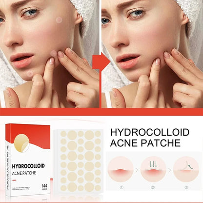 144-Piece Invisible Acne Patches - Pimple Cover Stickers for Daily Facial Skincare and Spot Care
