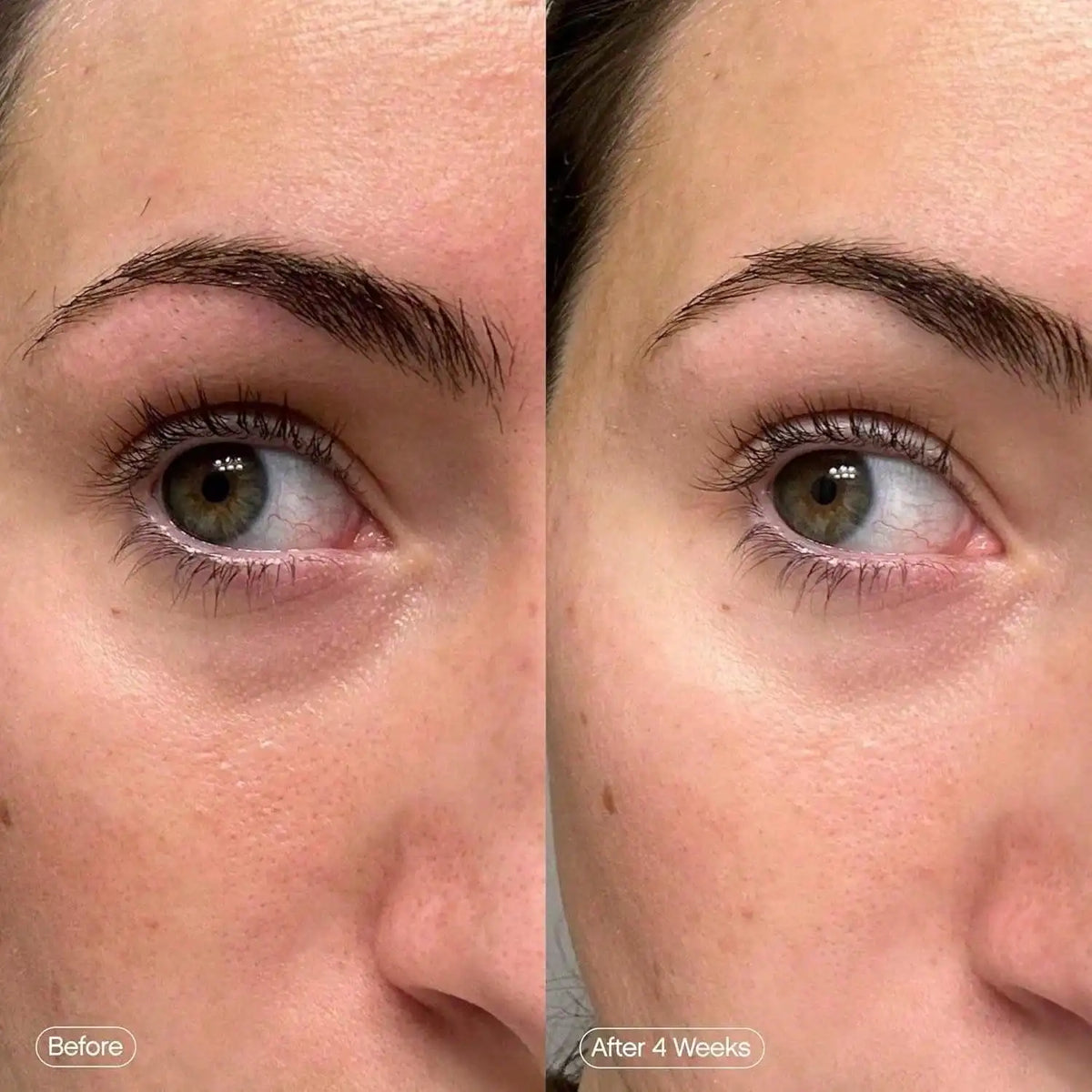 Brightening Facial Mask Patches - Hydrating Dark Circle & Fine Line Care Treatment