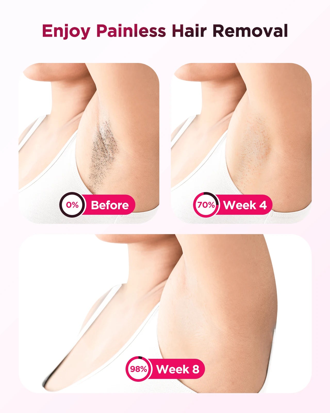 990000 Flash Laser IPL Hair Removal Machine – Painless Permanent Body & Facial Epilator for Men & Women | Bikini, Underarm & Full Body At-Home Hair Remover Device