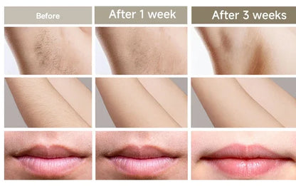 IPL Laser Hair Removal Device – 999,999 Flashes Painless Epilator for Women, Permanent At-Home Bikini & Body Hair Removal