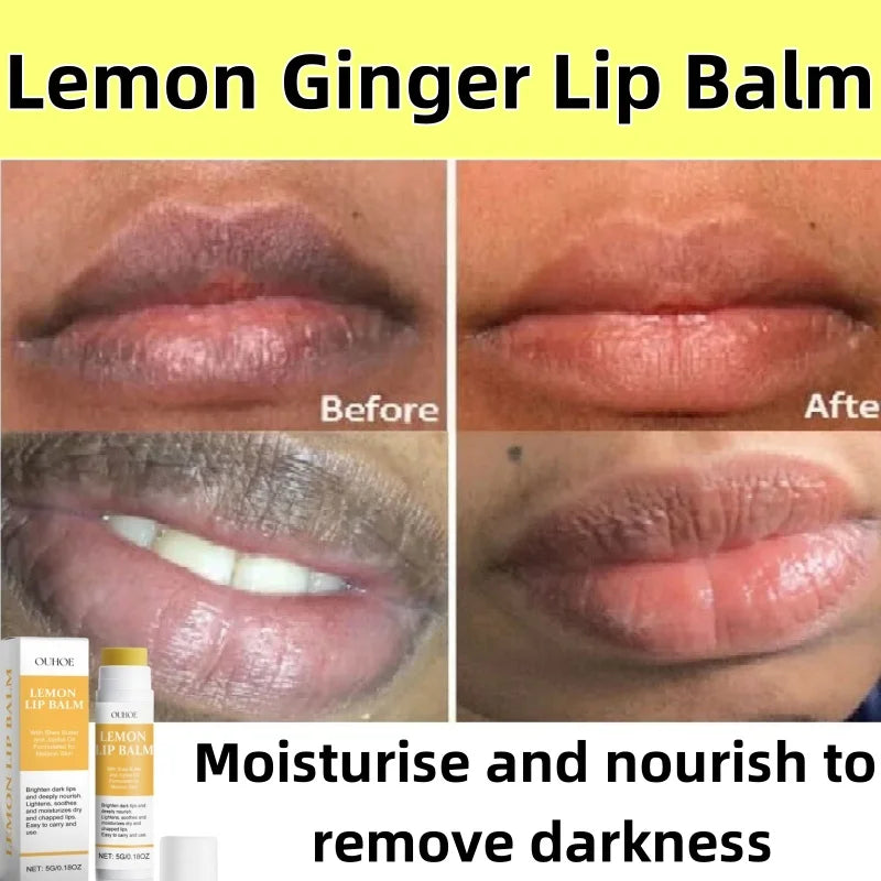 Lip Lightening Balm – Melanin Removing Gloss for Exfoliating and Moisturizing
