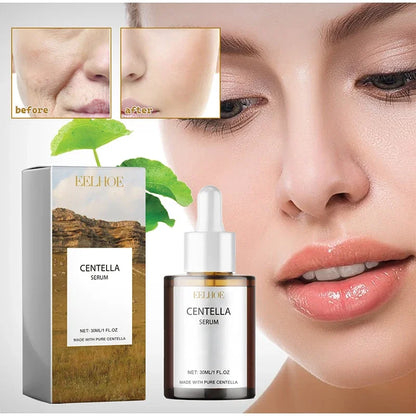 Centella Asiatica Face Serum – Nourishing, Brightening & Moisturizing Cream for Dry Skin Rejuvenation