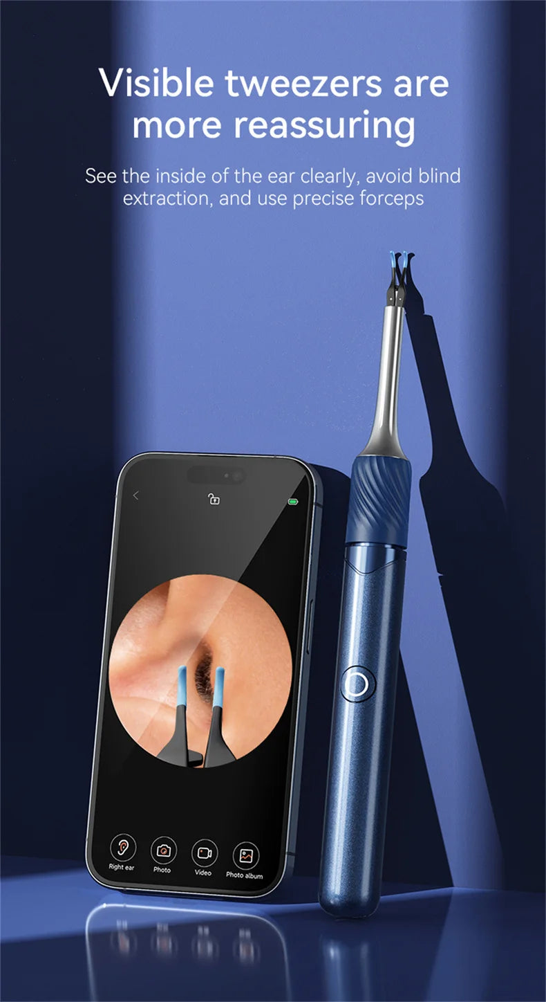 Visual Ear Cleaner with Camera – 12MP Ear Wax Removal Tool with Ear Pick, Tweezers & 6 Ear Spoons for Ear Care