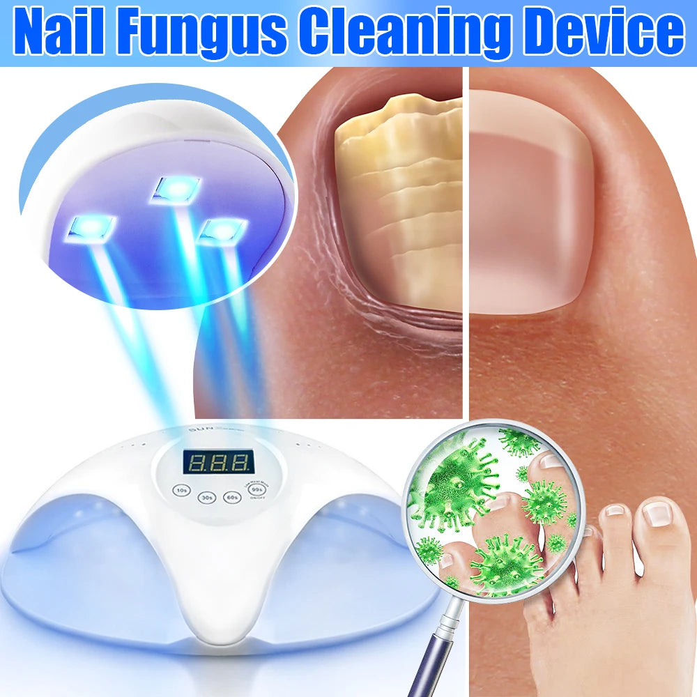 Fungal Nail Laser Device – Fast Toenail & Fingernail Fungus Repair, Onychomycosis Treatment for Hand & Foot Care