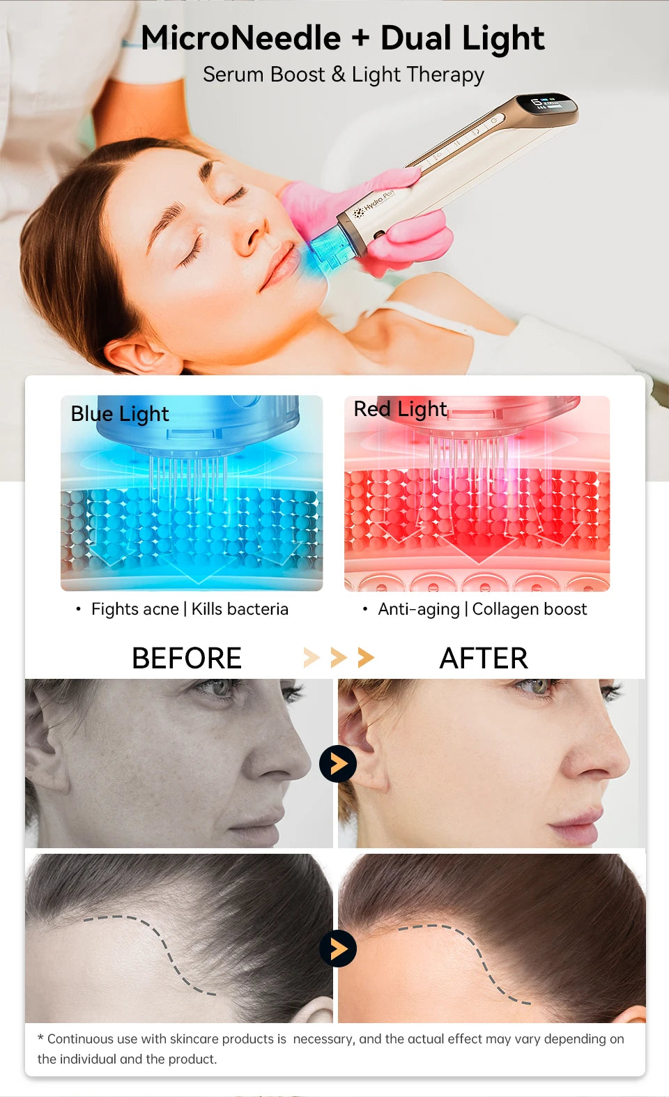 Dr. Pen H6 Microneedling Pen - Serum Infusion & Light Therapy Facial Skin Care Device