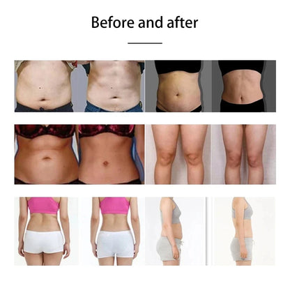 Professional Emsone Neo RF Body Slim Machine EMS Fat Burning Muscle Toning Equipment Upgrade Nova EMSzero