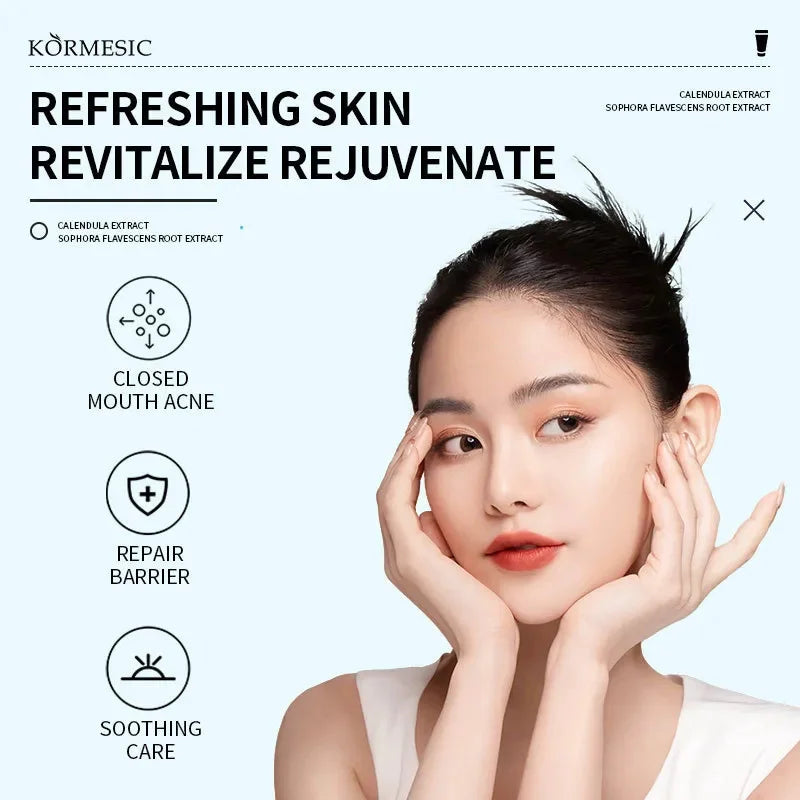 Effective Acne Removal Cream 30g – Anti-Acne Gel for Redness, Pimples, Deep Pore Cleaning & Oil Control Skin Care