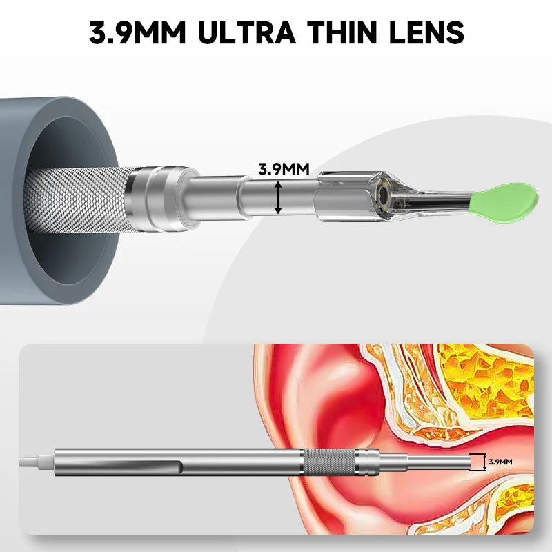 4.5-Inch HD Digital Otoscope - 1080P Ear Camera with 3.9mm Lens & 6 LEDs for Ear Wax Removal, Kids & Adults