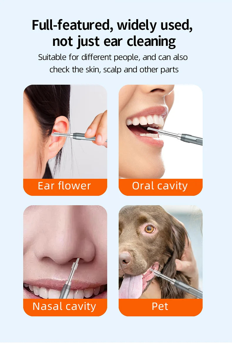 DDCAMERA 4.3" Digital Otoscope – 1080P Ear Scope with 6 LED Lights for Ear Wax Removal, Photo & Video Support