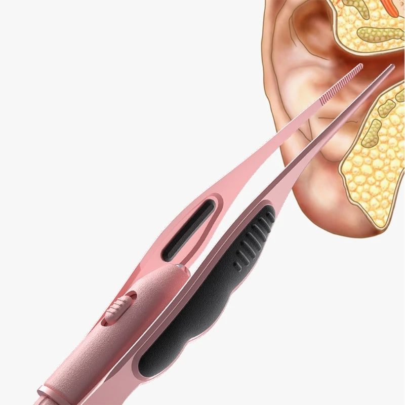 LED Ear Wax Removal Tweezers - Anti-Slip Lighted Ear Pick & Earwax Cleaning Tool