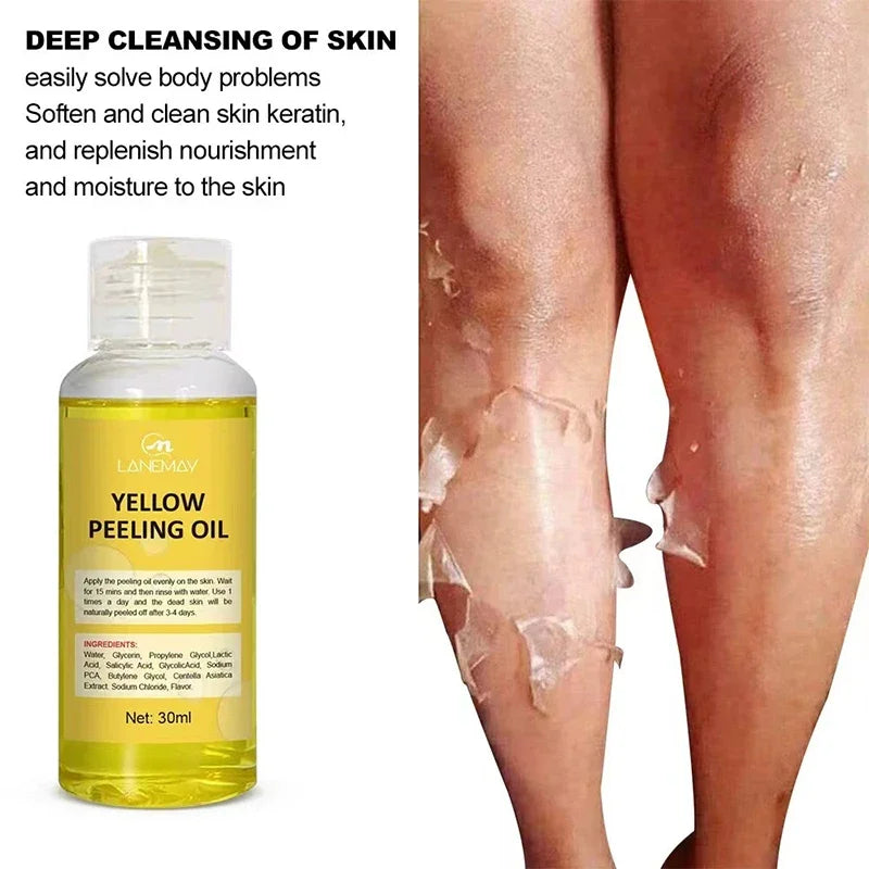 Body Care Exfoliating Yellow Peeling Oil – 100% Organic Dark Skin Whitening Serum for Dark Knuckles and Fast Bleaching