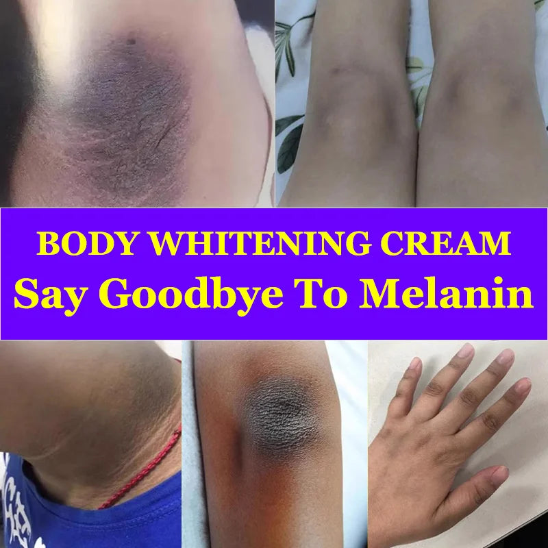 Whitening Cream for Private Parts – Underarm, Inner Thigh & Knee Brightening Serum