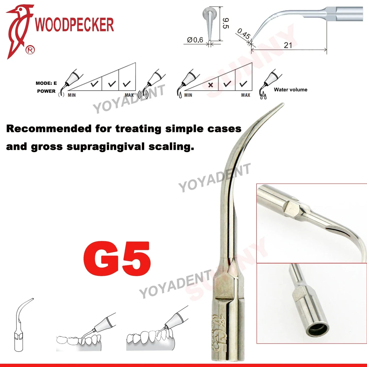 Woodpecker Dental Scaler Tips – Ultrasonic Tooth Cleaning, Endo & Perio Scaling Tips, Fit EMS UDS Scaler Handpiece