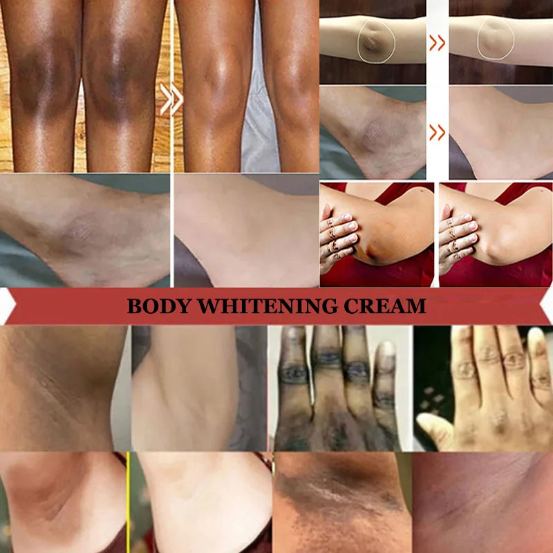 Whitening Cream for Private Parts – Underarm, Inner Thigh & Knee Brightening Serum