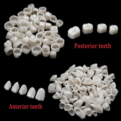 50/100pcs Dental Temporary Crown Resin Veneers – Porcelain Teeth Materials for Anterior & Posterior Teeth Restoration