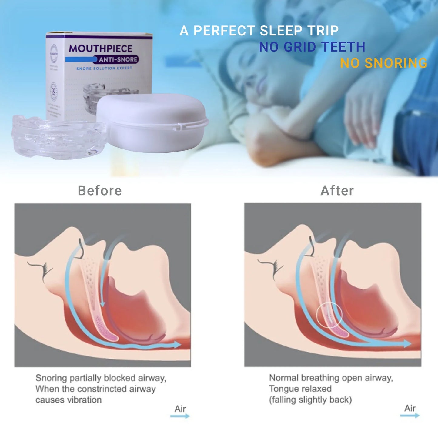 Silicone Anti-Snore Mouthpiece – Mouth Guard for Snoring, Bruxism, Sleep Apnea, and Teeth Protection