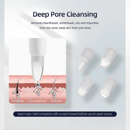 Foreverlily Diamond Facial Peeling Machine – Home Microdermabrasion & Nano Water Spray Exfoliator