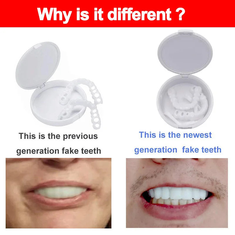 Teeth Veneers & Whitening Denture Kit – Temporary False Teeth Cover for Comfortable, Perfect Smile