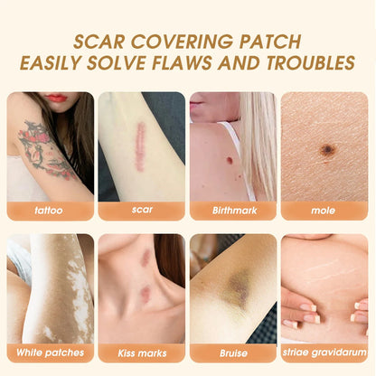 Invisible Skin-Tone Tattoo Cover Patches - Natural-Looking Birthmark Concealer for Arms, Legs, Back, and Post-Surgery Coverage