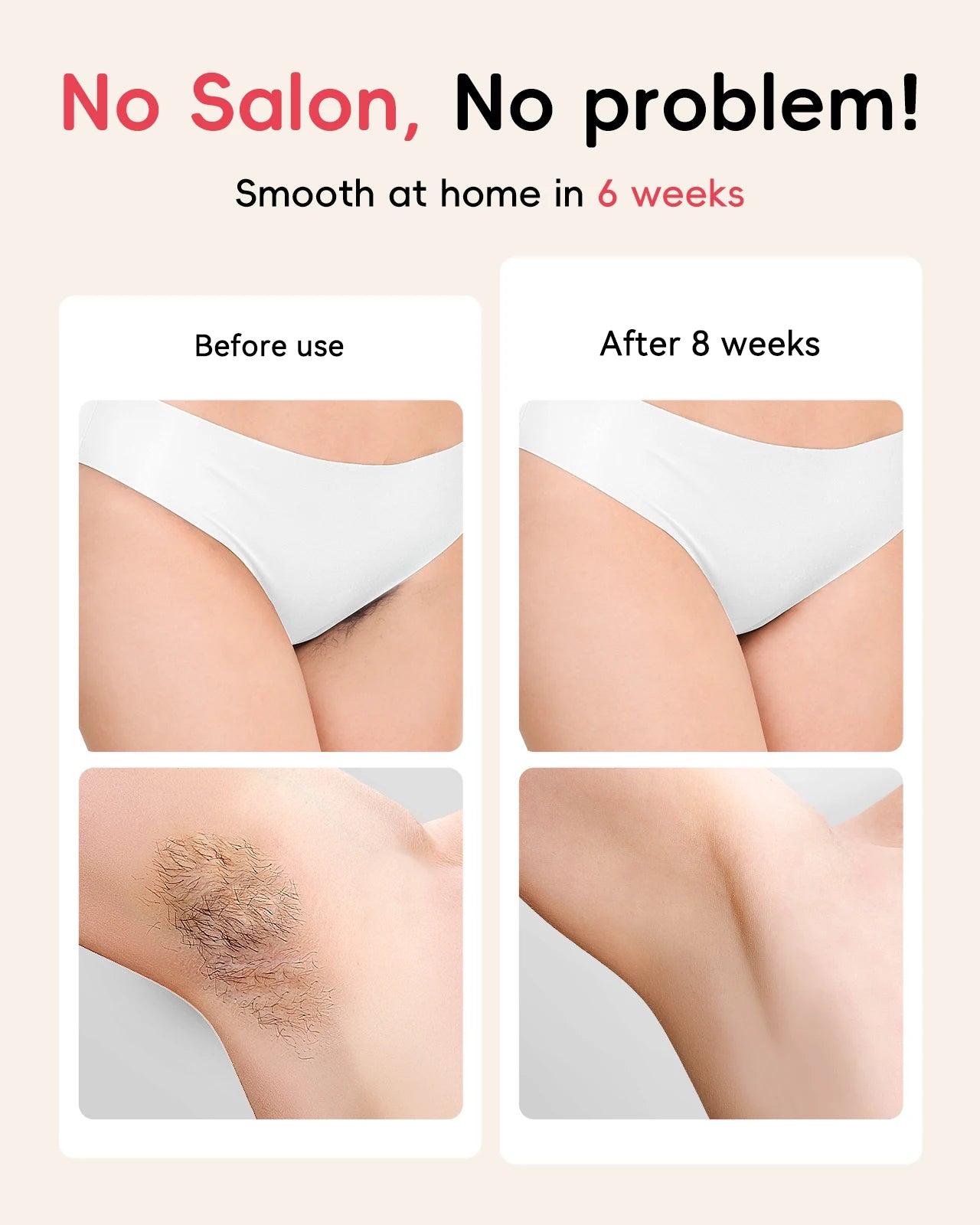 IPL Hair Removal Laser 22J — Unlimited Flashes IGBT, 5.2cm² Light Painless Epilator for Face, Armpit & Bikini Body Treatment